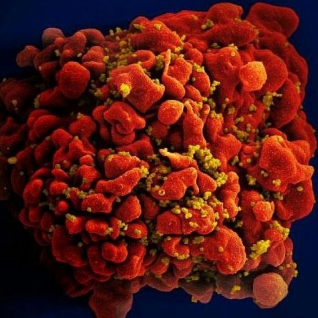 Image depicting VB Variant - New HIV Strain discovered in the Netherlands